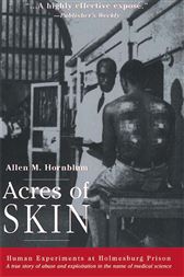 Acres of Skin