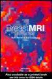 Breast MRI in Practice