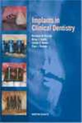 Implants in Clinical Dentistry