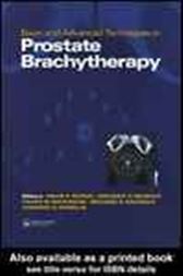Basic and Advanced Techniques in Prostate Brachytherapy