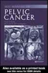 MRI Manual of Pelvic Cancer