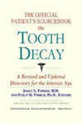 The Official Patient's Sourcebook on Tooth Decay