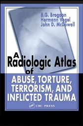 Radiologic Atlas of Abuse, Torture, Terrorism, and Inflicted
