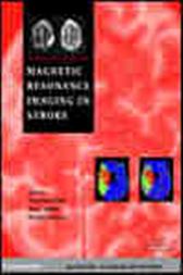 Magnetic Resonance Imaging in Stroke