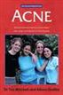 Acne - The 'At Your Fingertips' Guide