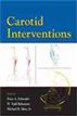 Carotid Interventions