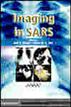 Imaging in SARS