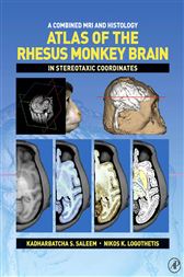 A Combined MRI and Histology Atlas of the Rhesus Monkey Brain