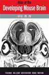 Atlas of the Developing Mouse Brain at E17.5, P0 and P6