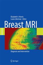 Breast MRI