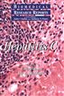 Hepatitis C