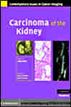 Carcinoma of the Kidney