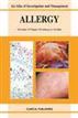 Allergy