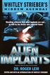 Casebook: Alien Implants