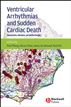 Ventricular Arrhythmias and Sudden Cardiac Death