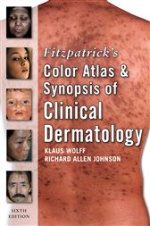 Fitzpatrick's Color Atlas and Synopsis of Clinical Dermatology, Sixth Edition