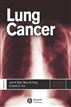 Lung Cancer
