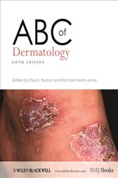 ABC of Dermatology