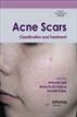 Acne Scars