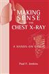 Making Sense of the Chest X-ray