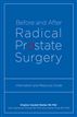 Before and After Radical Prostate Surgery