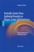 Varicella-Zoster Virus Epithelial Keratitis in Herpes Zoster Ophthalmicus