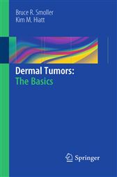 Dermal Tumors