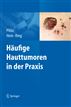 Häufige Hauttumoren in der Praxis