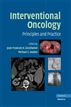 Interventional Oncology