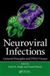 Neuroviral Infections