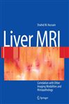 Liver MRI - Hussain, Shahid M.