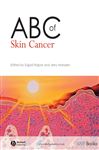 ABC of Skin Cancer - Rajpar, Sajjad; Marsden, Jerry