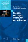 Imagerie en coupes du cœur et des vaisseaux - Joffre, F.; Guret, Pascal